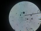 Siva Plijesan S Kruha Pod Mikroskopom Uveana 100X...Vide Se Sporangij I Razasute Spore